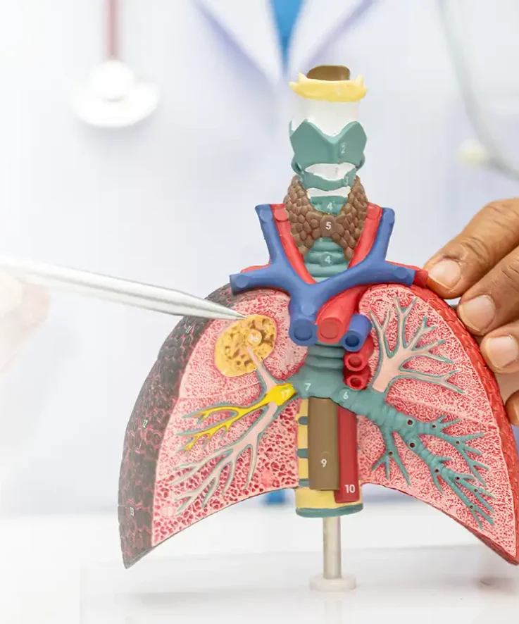 Chennai Institute of Pulmonology Chennai Institute of Pulmonology