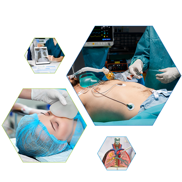 Bronchoscopy Lobectomy