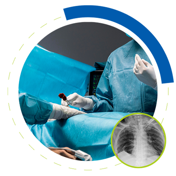 Bronchoscopy