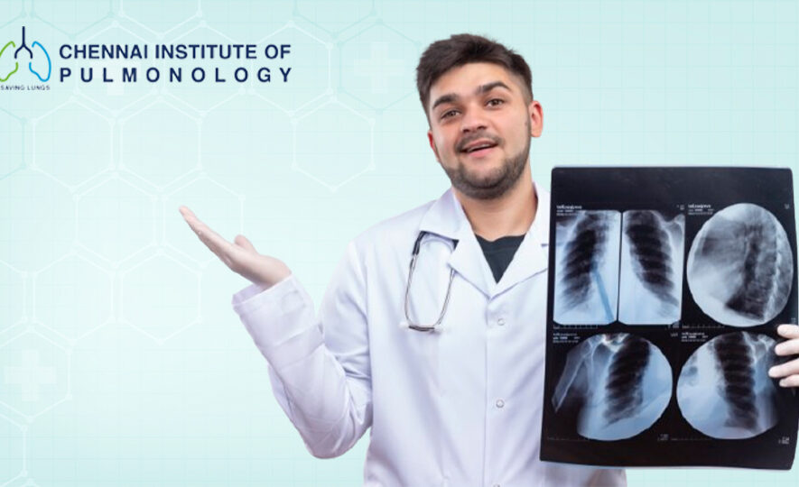 best thoracic surgeon