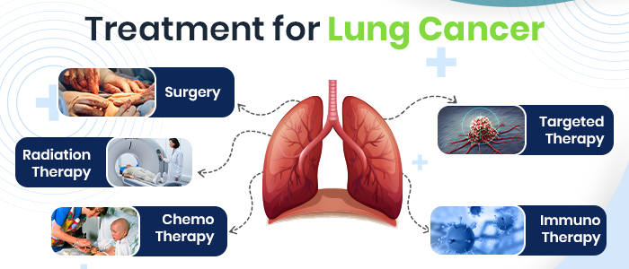 Treatment for Lung Cancer